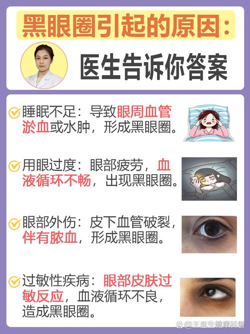 眼眶黑是什么原因