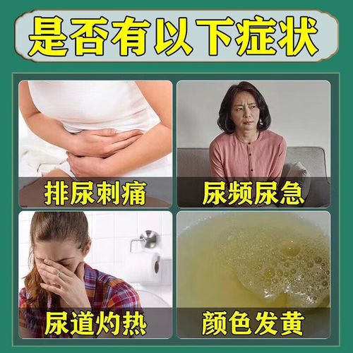 女人尿急吃什么药