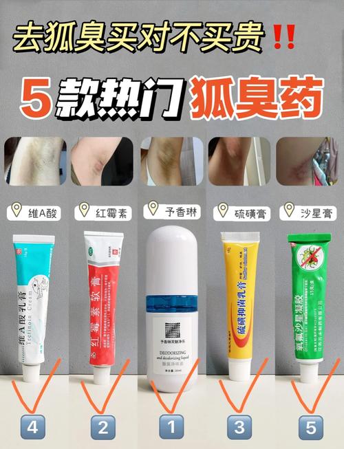 什么去狐臭效果好