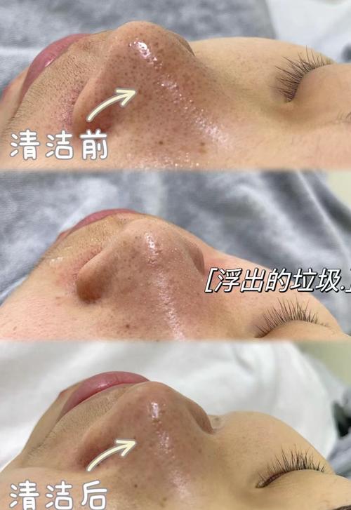 什么是面护