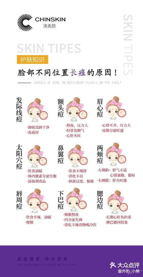 脸上长痘痘是为什么