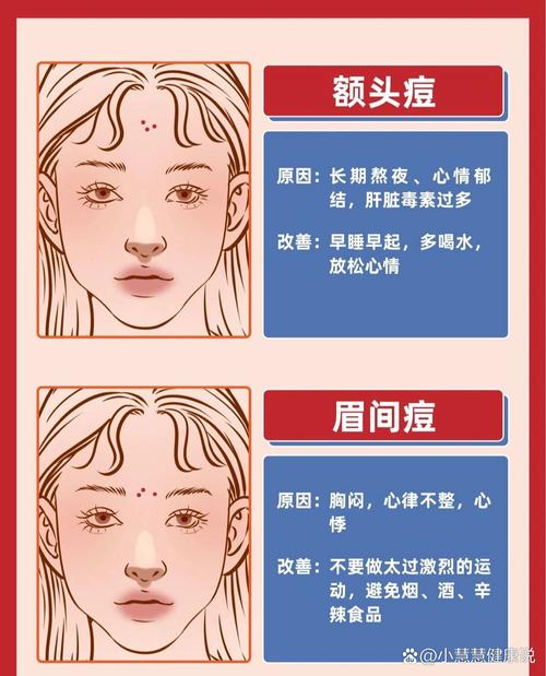 脸上长痘痘是为什么