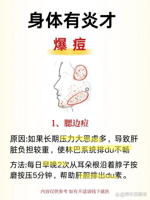 下巴长痘看什么科