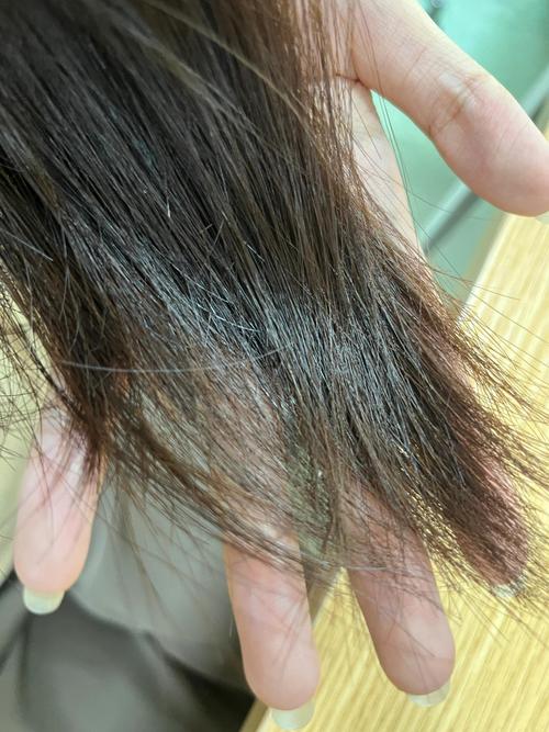 白醋洗头有什么好处