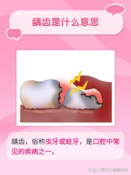 龋牙是什么意思