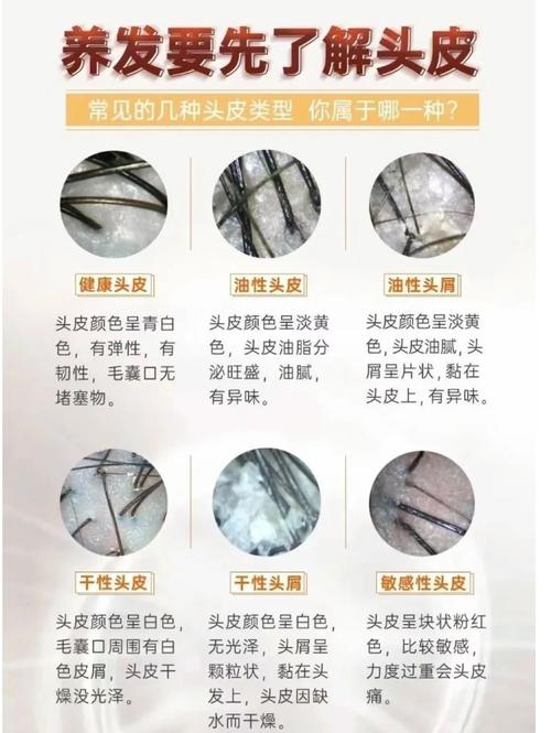 看头发看什么科