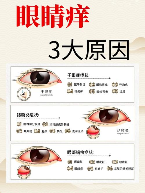 眼睛发干是什么原因