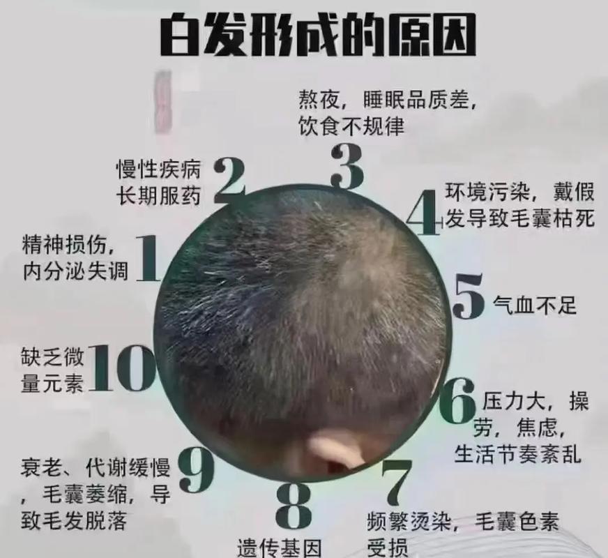 头发白是因为什么