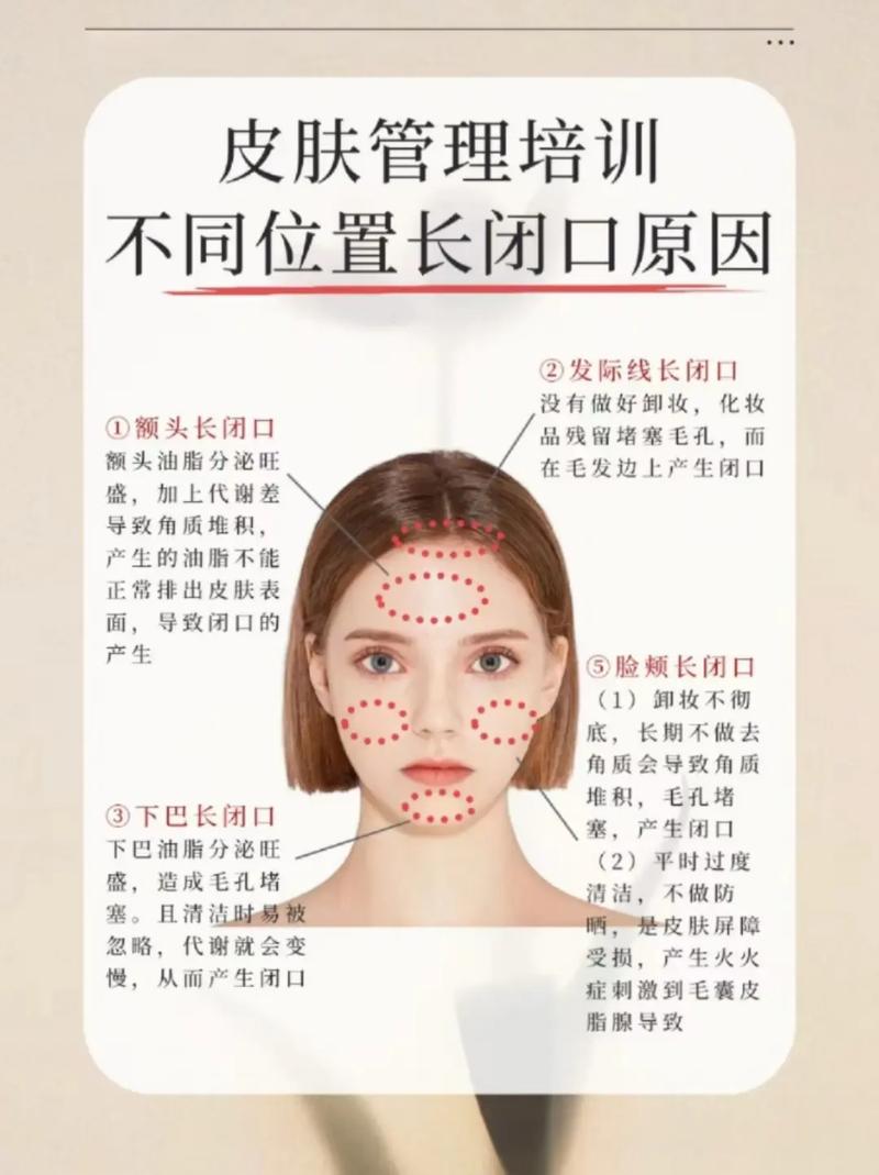 长闭口什么意思