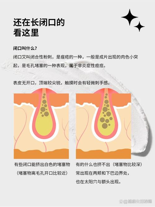 长闭口什么意思