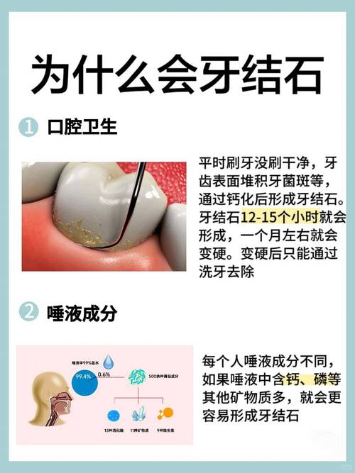 什么可以去除牙结石