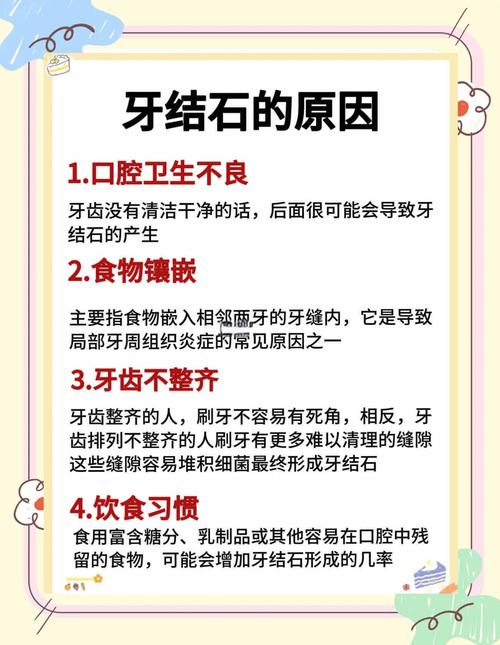 什么可以去除牙结石