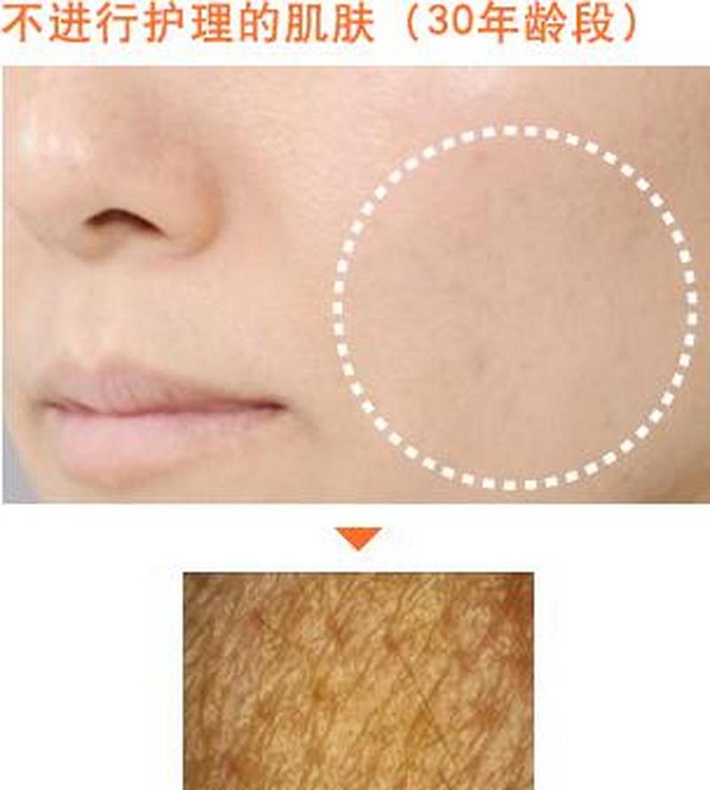 什么是角质图片