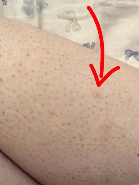 什么是角质图片