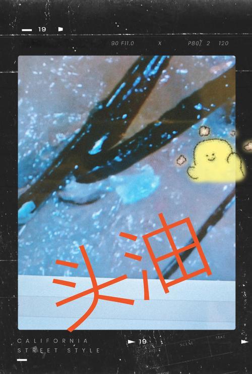 为什么头发很容易油