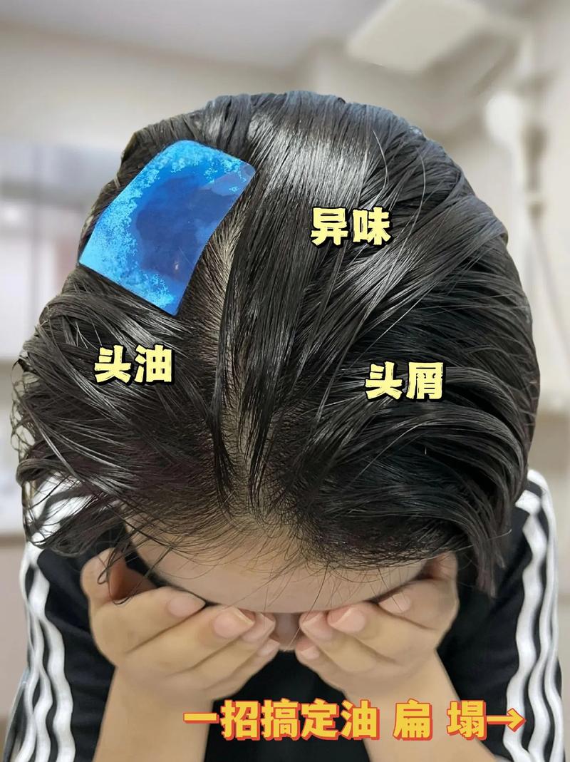 为什么头发很容易油