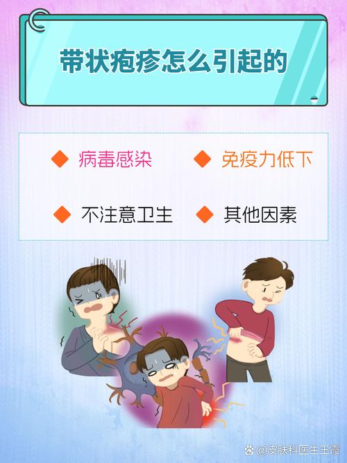 带状疱疹是什么引起