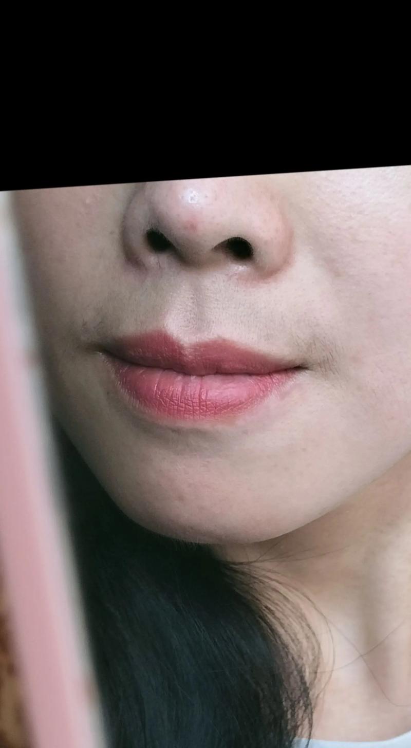 女的为什么长胡子