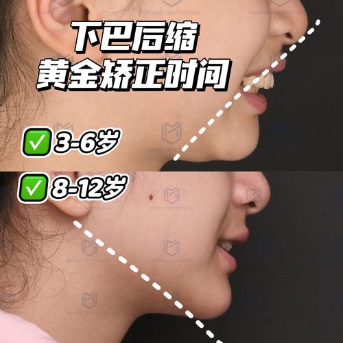 下巴黄是什么原因