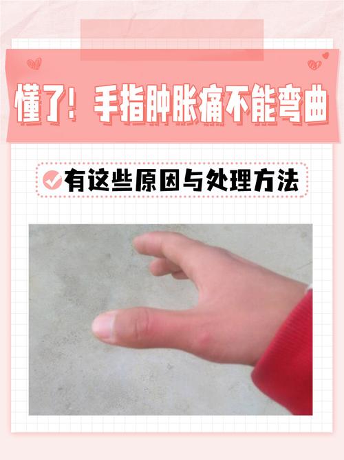 手指水肿是什么原因