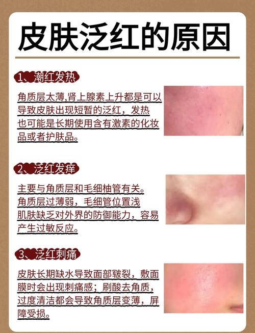 脸上为什么有血丝