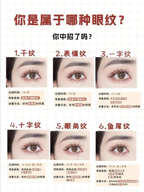 为什么会长眼纹