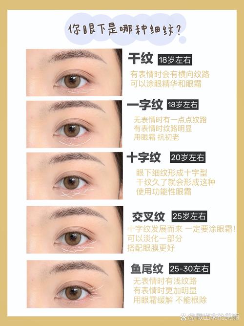 为什么会长眼纹