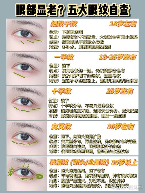 为什么会长眼纹