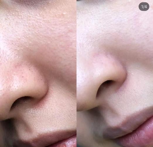 科颜氏白泥最新价格