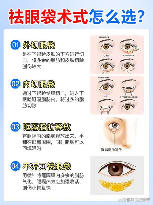 什么方法能去眼袋