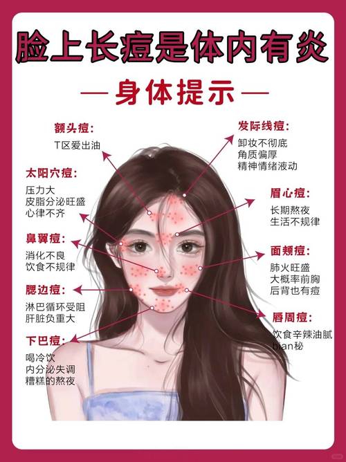 突然长痘痘是什么原因