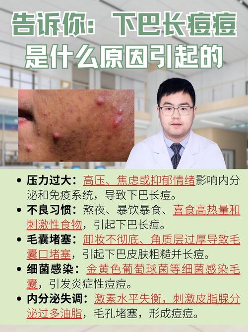 突然长痘痘是什么原因