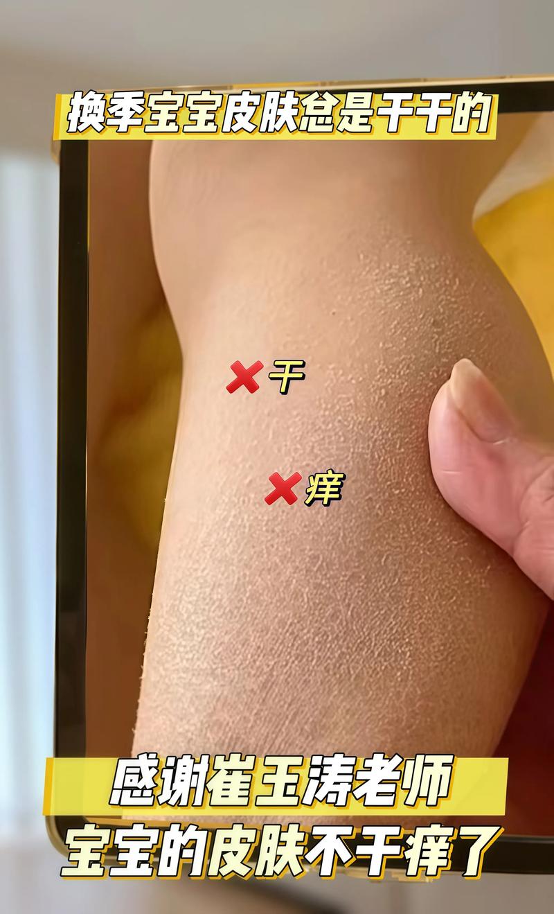 身上起皮是什么原因