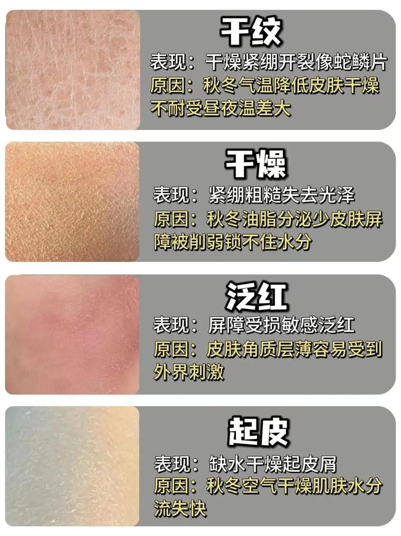 身上起皮是什么原因