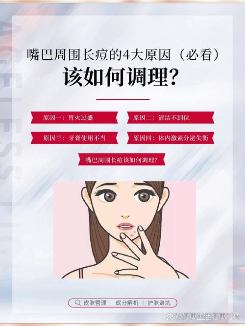 嘴周围长痘什么原因