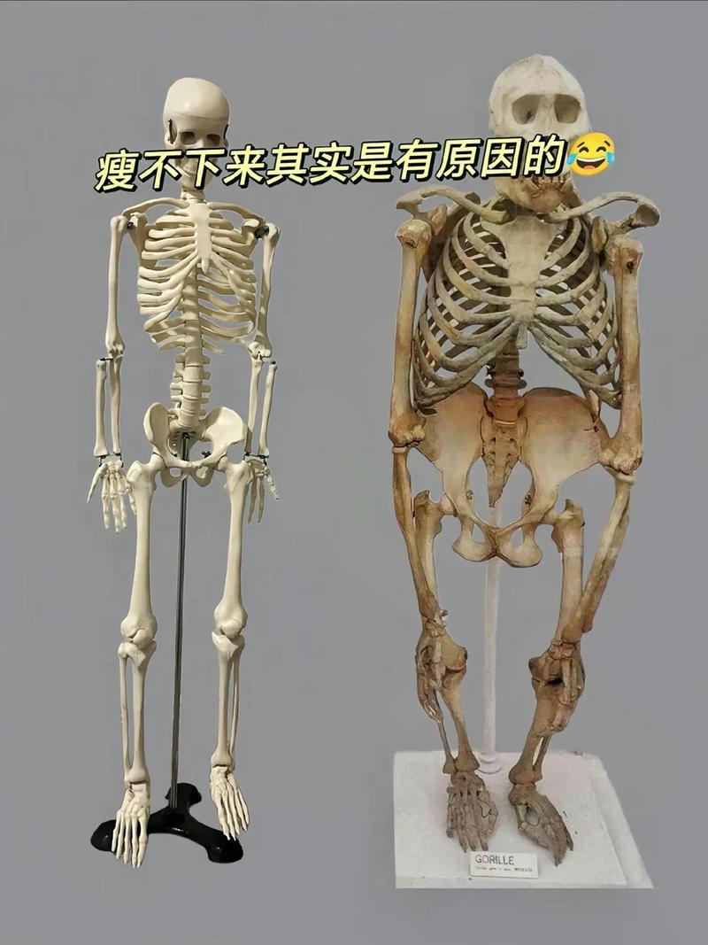 骨架大是什么原因