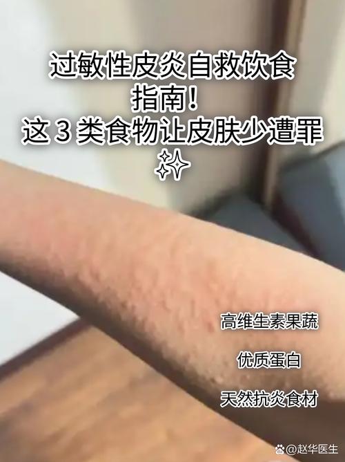 脸上过敏能吃什么