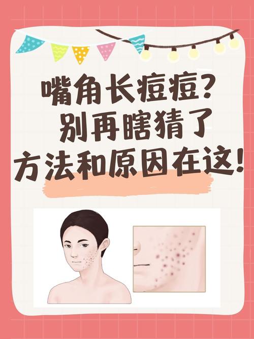 为什么嘴边长痘痘