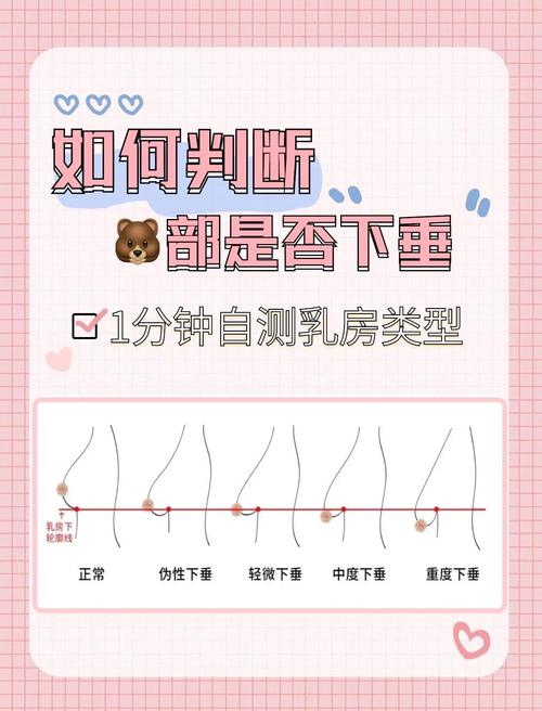 为什么乳房会下垂