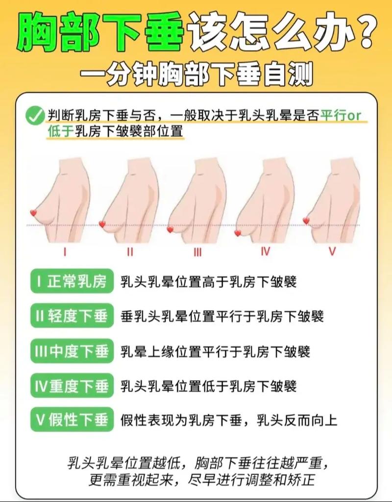 为什么乳房会下垂