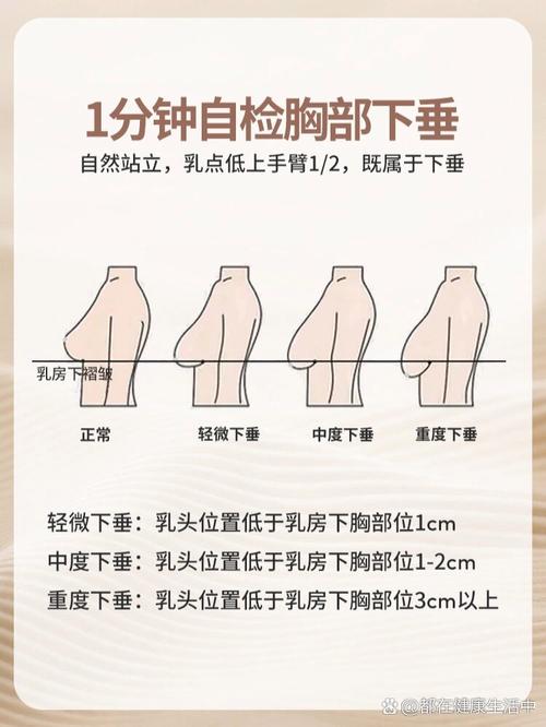 乳房为什么会下垂