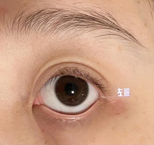 为什么没有下睫毛