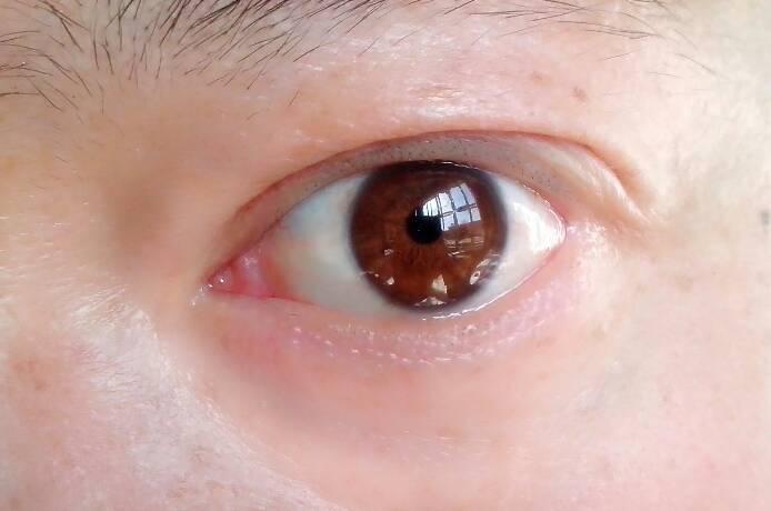 为什么没有下睫毛