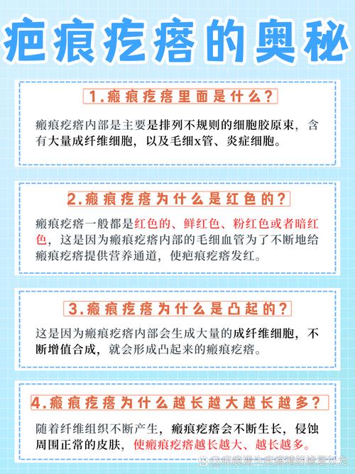 瘢痕疙瘩挂什么科