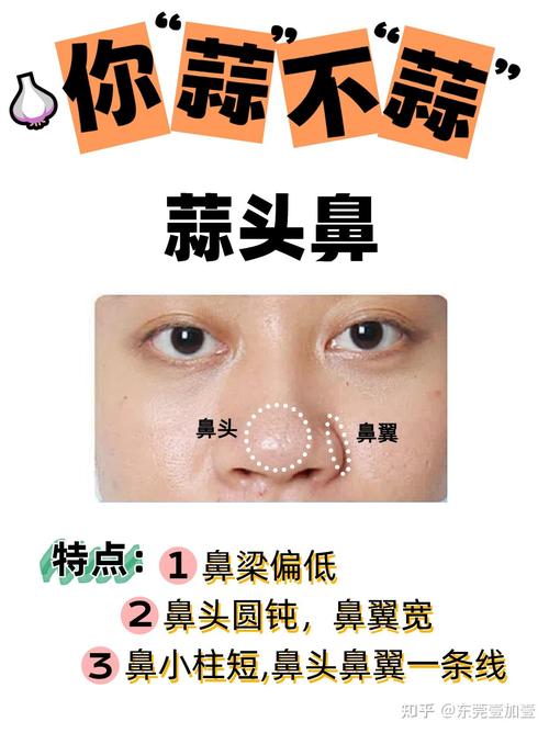 什么是蒜头鼻