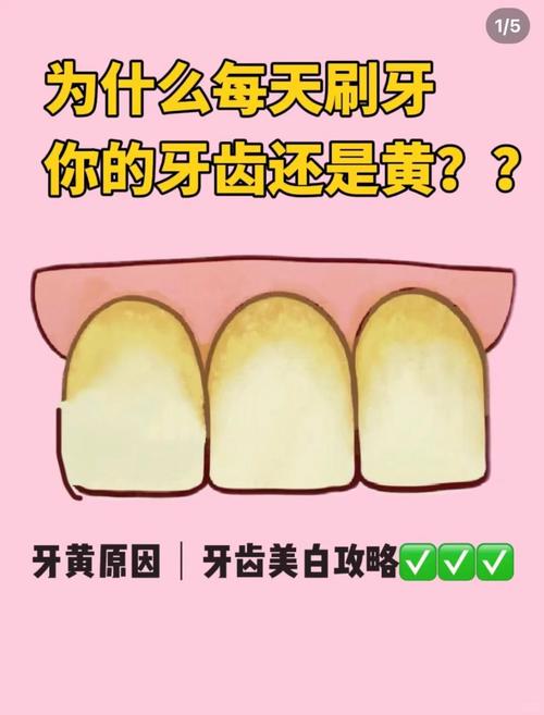 黄牙什么原因