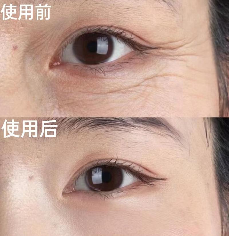 什么去皱纹效果最好