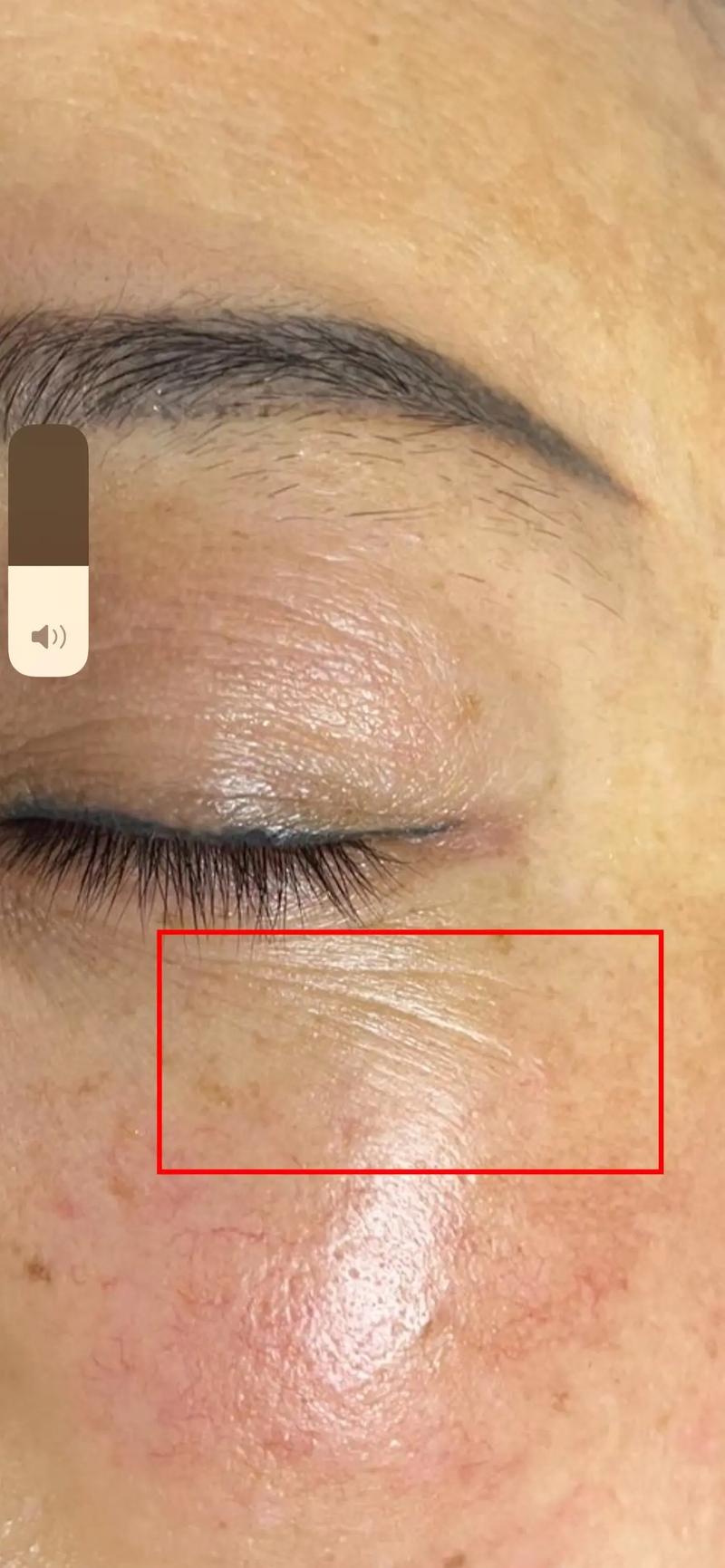 什么去皱纹效果最好