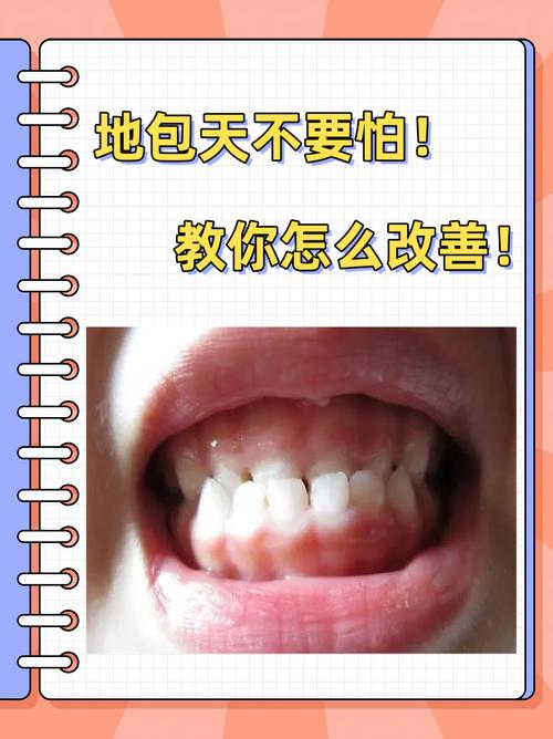 地包天有什么影响