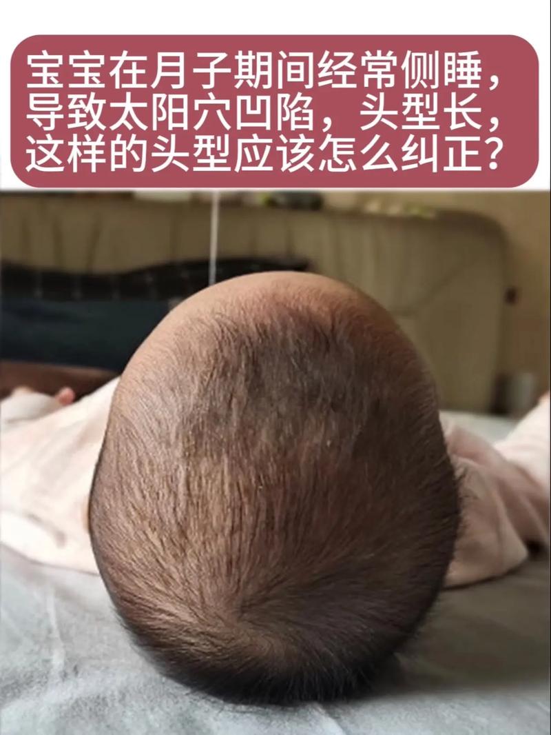 为什么太阳穴会凹陷